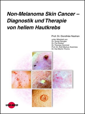 cover image of Non-Melanoma Skin Cancer--Diagnostik und Therapie von hellem Hautkrebs